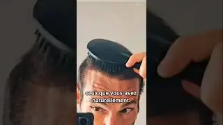 🎤 Les diff&eacute;rentes &eacute;tapes de la repousse capillaire apr&egrave;s une greffe de cheveux DHI (sous titr&eacute; FR)