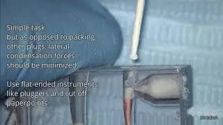 MTA Exercise #4: Strip perforation repair with MTA