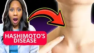 WHAT IS HASHIMOTO&rsquo;S DISEASE? A Doctor Explains 