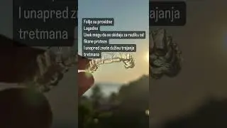 DentAlign providne folije za ispravljanje zuba.