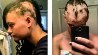 Living With Alopecia | HeyThereImShannon