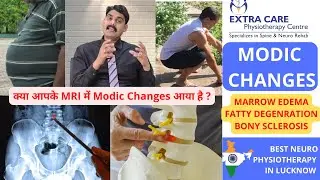 MODIC CHANGES in Lower BACK | Lumbar Spine MRI | Disc Degeneration & Endplate Changes