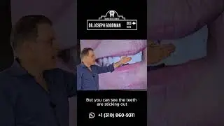Non-Surgical FACE Dentistry&trade;: Transform Your Profile Without Jaw Surgery | Dr. Joseph Goodman
