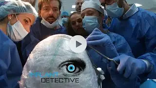 Monoblock implant Course / Curso de Implantes Monobloque
