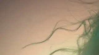 serotonine selfdistruction