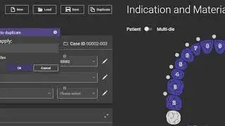 How to align meshes in exocad for all on x surgical prosthetic conversion