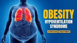 Obesity Hypoventilation Syndrome | OHS | Symptoms & Treatment | 3D Animation | ERemedium