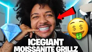 Unboxing $1000 Custom MOISSANITE Grillz From ICEGIANT! 🤑💎