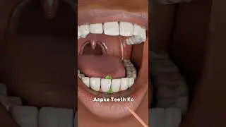 How Toothpicks Can Harm Your Teeth and Gums Explain🧏🏻&zwj;♀️ (3D Animation) #short