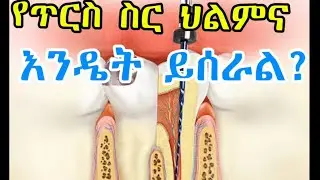 የጥርስ ስር ህክምና እንዴት ይሰራል ?
