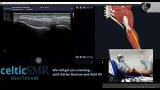 **CLIP** CelticSMR MSK Sonography: Tips for locating the common extensor origin