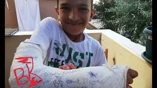 Suriyeli Muhammet  Kolu Kırınca, Güvercinleri Kaptı.