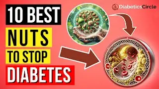 10 Best Nuts For Diabetics