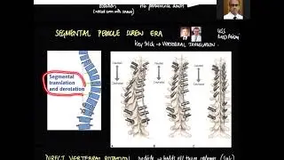 History of Corrective maneuvers in Adolescent Idiopathic Scoliosis surgery by Dr Kshitij Chaudhary