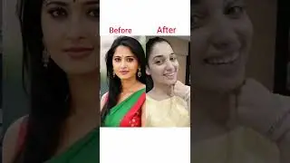 Bollywood Actress Before & After Transformation 😱 | Then vs Now 2026