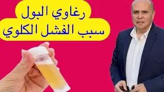الجزء الاول من البث المباشر هل رغاوي البول تدل علي فشل كلوي وماهي علامات فشل الكلي والتحاليل
