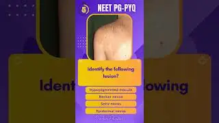 NEET PG PYQs - DERMATOLOGY | High Yield MCQs |Image Based |INICET | MRB | #neetpg #fmge #inicet #mrb