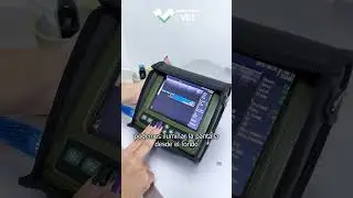 ESTO es lo que puedes hacer con el ecógrafo portátil KAIXIN V1