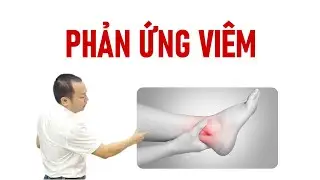 Inflammation - Phản Ứng Vi&ecirc;m - Phần 2