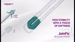 JoinFix All-Suture Anchor - REJOIN Medical