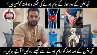 Joint stiffness after surgery, causes and treatment 