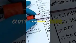 Understanding PT and aPTT Tests: Your Guide to Blood Thinner Monitoring