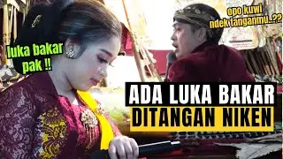 Ternyata Ditangan Niken Salindry Ada Luka Bakar, Kok Bisa Ya ???
