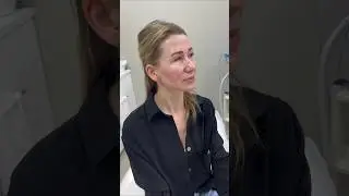 Фотоомоложение лица, фототерапия розацеа. Как выглядит кожа сразу после процедуры