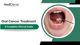 Oral (Mouth) Cancer Treatment Guide | Early Signs, Treatment Options & Recovery
