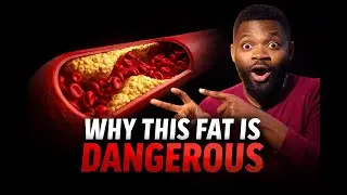 Dealing with the bad cholesterol 