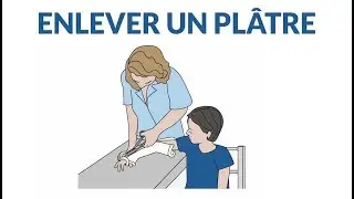 Comment enlever un plâtre ?