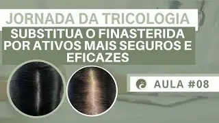 Ativos Mais Eficazes Que a Finasterida? Descubra Alternativas Avançadas! | Jornada da Tricologia #08