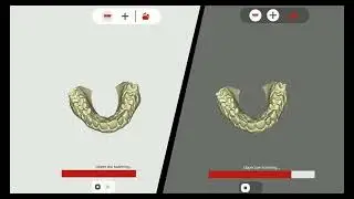 Where Innovation Meets Precision:Your Trusted Dental Scanner!🥳🥳🥳