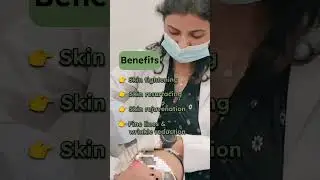 Fractional Non Ablative Erbium Glass Laser #lasertreatment #skintreatment #skincare