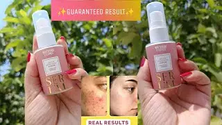 . Alpha Arbutin + Glutathione Serum ✨🎀| Powerful Skin Brightening Formula for Glowing Skin|Flawless|