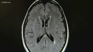 What to look for when it comes to declining cognitive health