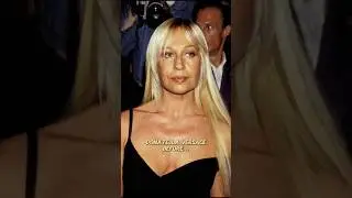 Extreme plastic surgery fail😲😲#celebrity #transformation #shorts