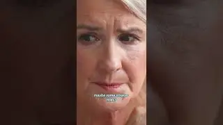 Laser Lip Rejuvenation Tampa