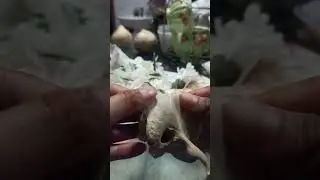 Temporal bone part 2