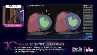 Role of Synapse 3D in Cardiac Analysis