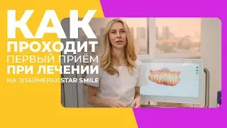 Как происходит первый приёме при лечении на элайнерах? #starsmile #безбрекетов