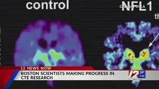 Boston University scientists getting close to diagnosing CTE in living people