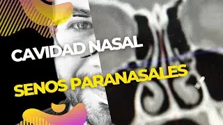 Cavidad Nasal, Senos Paranasales y Bulbo Olfatorio