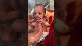 Cute Baby Observatio  🩺👶 | Gentle NICU Care