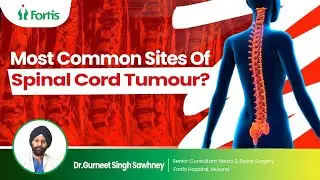 Spinal Cord Tumor in Hindi | Spinal Cord Tumor - Causes, Types, Symptoms & Treatment | MUL