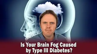 Is Your Brain Fog Caused by Type III Diabetes?