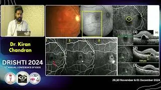 KSOS2024 IC78 T  Dr Kiran Chandran Multimodal imaging in CSR