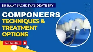 Componeers | Direct composite veneering | Cosmetic Bonding | Coltene | Cosmetic Dentistry Delhi |