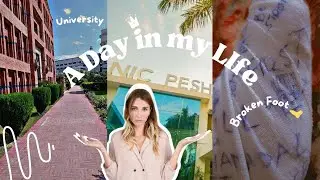First Day of University | First Day of 2nd Semester | Fast University Peshawar | I broke my Foot 🦶🥺