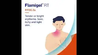 Flamigel&reg; RT - Stages of radiotherapy induced skin reactions